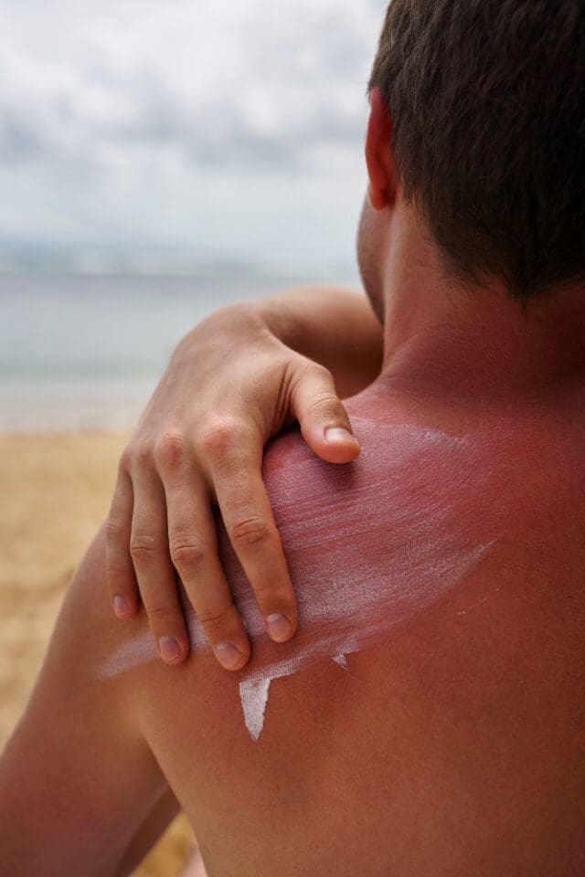 A Plastic Surgeon Explains the Truth About Sunscreens and Skin Damage from the Sun